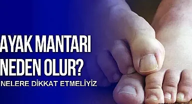 Ayak Mantarı Nedir? Belirtileri ve Tedavi Yöntemleri