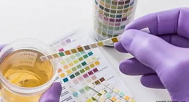 Protein kaçağı nedir, belirtileri nelerdir? Protein kaçağı olan bitkiler ve şifalı bitkiler. Bitkisel çaylar, bitki takviyeleri Protein Kaçağı Nedir?