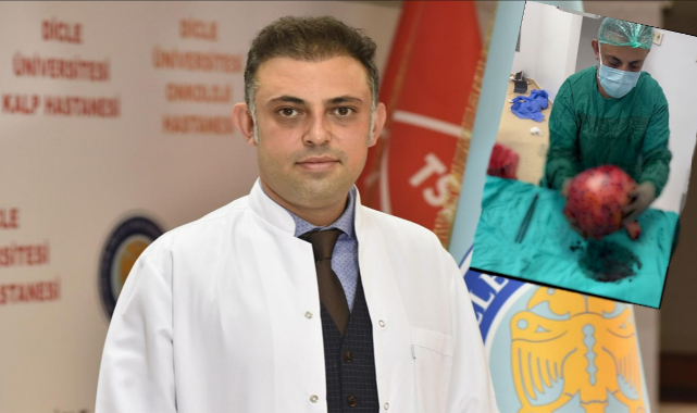 Doç. Dr. Nurullah Peker Tıp Dünyasında Bir Başarıya Daha İmza Attı: Dev Myomu Rahim ve Yumurtalıkları Korumayı Başararak Çıkardı!